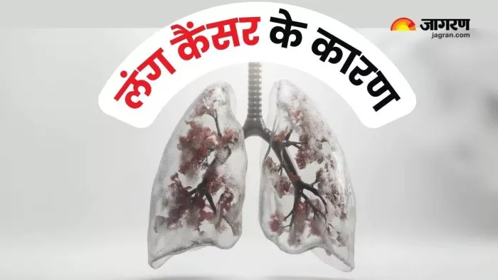 AIIMS research: Why lung cancer is increasing among the country’s youth? Shocking facts revealed: Delhi AIIMS research lung cancer is rapidly increasing among the youth of the country and shocking facts in the study