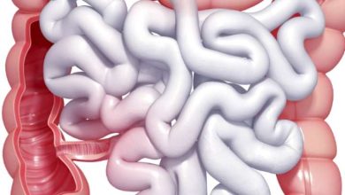 Do not ignore these indications of bowels