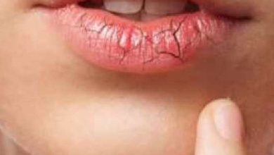 A lack of this vitamin starts to rid of it