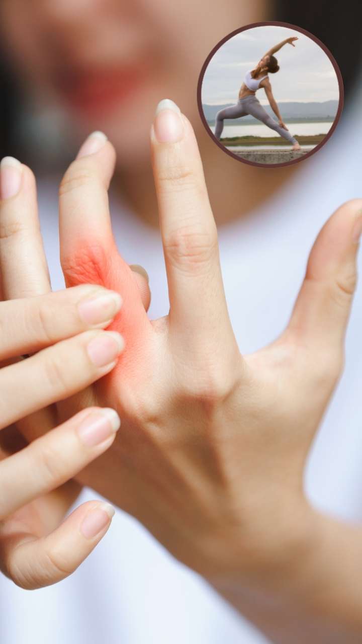 Do these 3 yogasanas to reduce the pain of arthritis