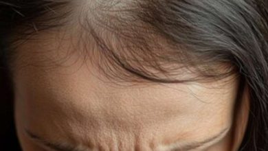White hair will be black, take these easy ways