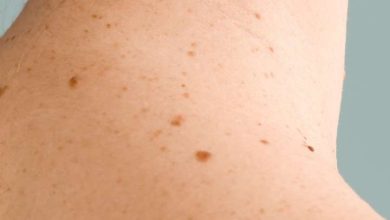 What parts of happy people have moles?