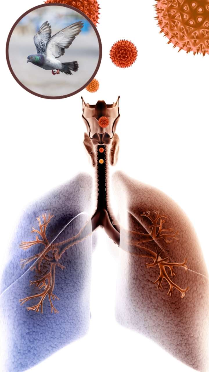 These diseases associated with lungs may occur as a result of the pigeon coming into the house