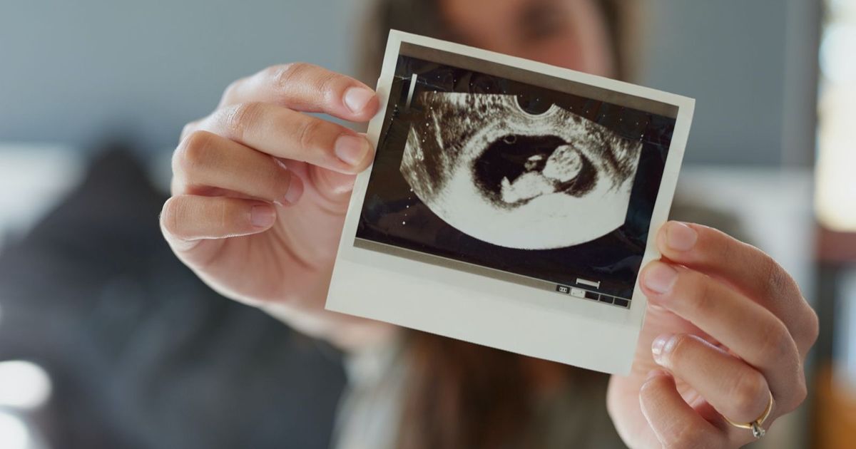 Artificial intelligence can detect the deformations of pregnancy at an early stage
