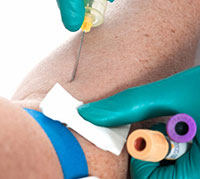 Blood examination: All that is known