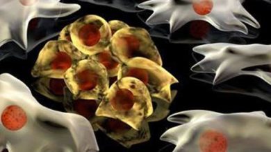 Cancer: Causes, Symptoms and Treatment