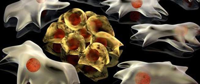 Cancer: Causes, Symptoms and Treatment