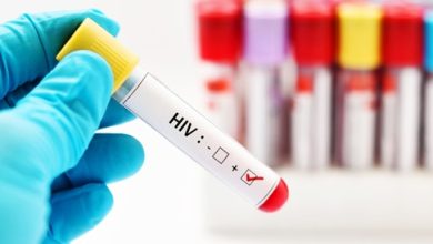الإيدز: الأعراض، والأسباب، والعلاج