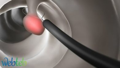 Watch the video: colonoscopy