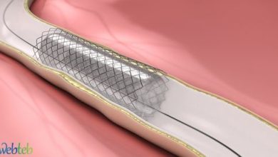Watch the video: Coronary Artery Catheter