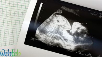 Video: Fetal photography ultrasound