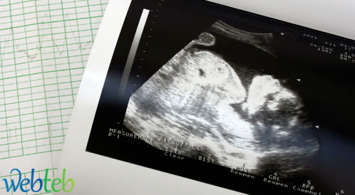 Video: Fetal photography ultrasound