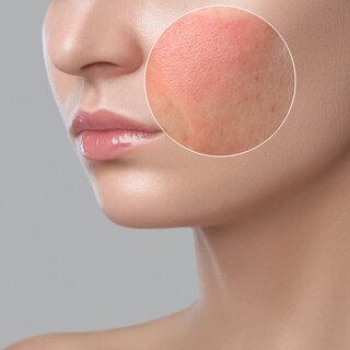 Look with photos: Types of dermatitis