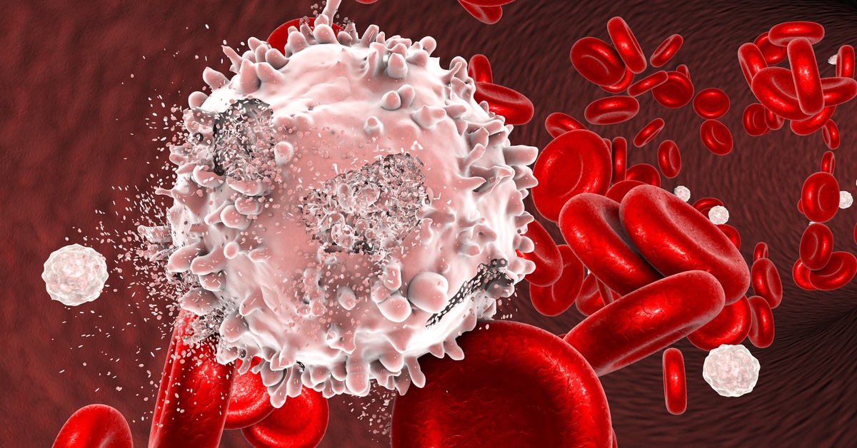 Methods to treat leukemia: Learn it