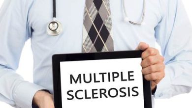 Poetic sclerosis: symptoms, causes and treatment