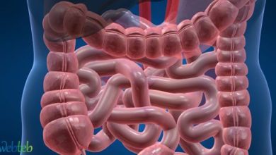 Watch the video: The effect of irritated colon column syndrome