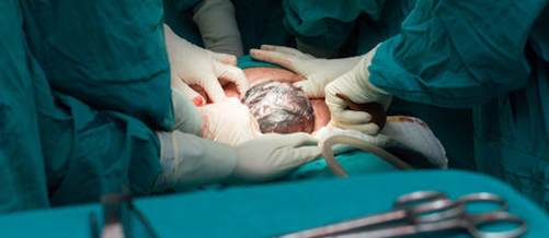 Video: The stages of the caesarean section