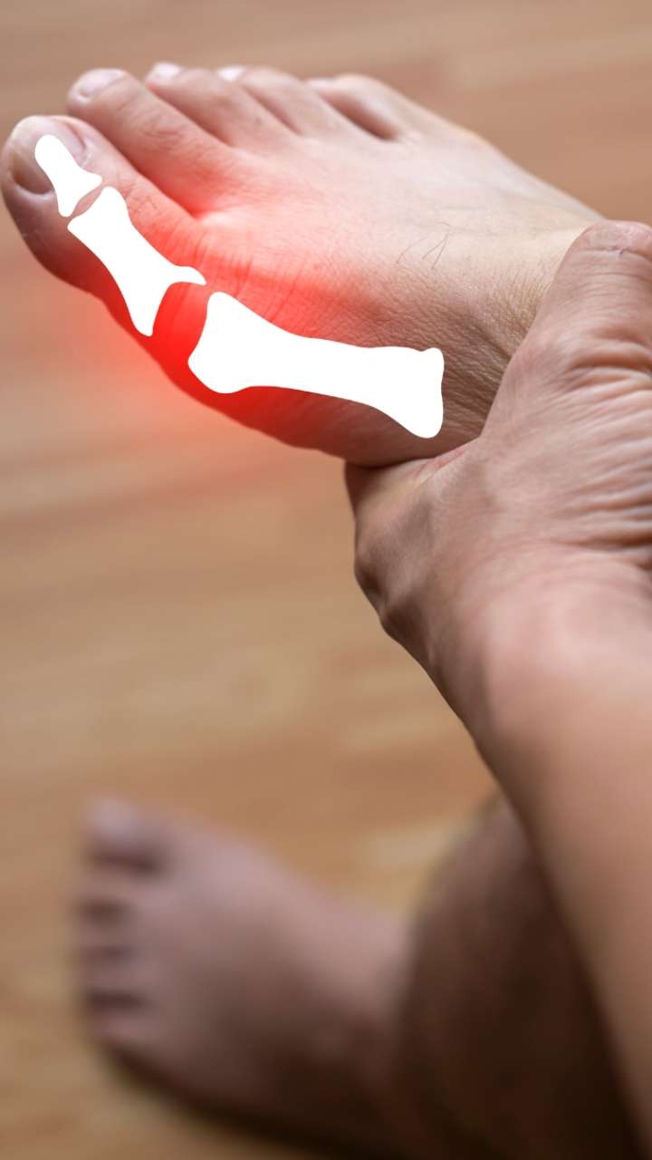 Does uric acid grow more than eating?