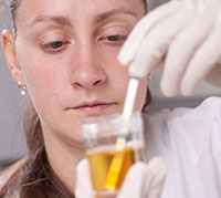 Urine examination: the method of performing the exam and analyzing the results