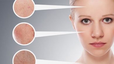 A video outline of the general causes of rash