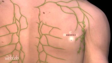 Watch the video: the biopsy of the knot
