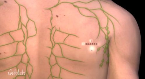 Watch the video: the biopsy of the knot