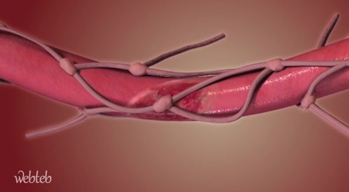 Watch the video: The process of eradicating the esophagus