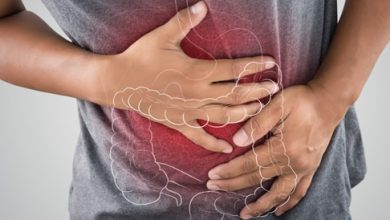 Irritable bowel syndrome: causes, symptoms and treatment