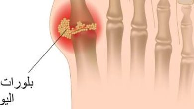 Jig: Causes, symptoms and treatment