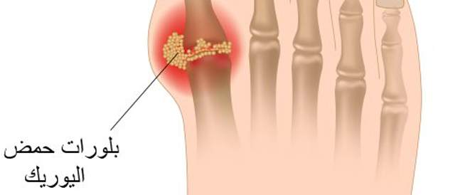 Jig: Causes, symptoms and treatment