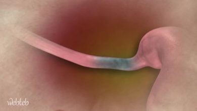 Watch in the video: dynamic visual therapy of the esophagus