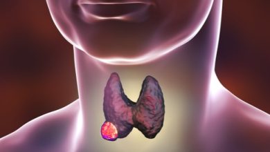 Thyroid Cancer: Causes, Symptoms and Treatment