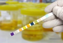 Urology: Causes, Symptoms and Treatment