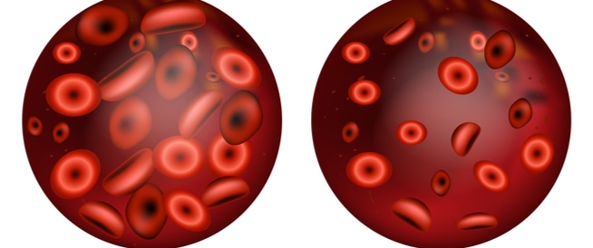Anemia: causes, symptoms and relationship