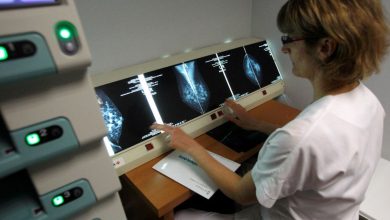 Study: a decrease in the number of deaths due to lung cancer