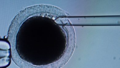 Study: AI’s abilities can increase the chances of success of artificial insemination