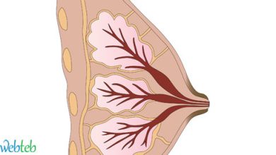 Video: Explanation of breast cancer