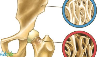 Know the video: Explanation of osteoporosis
