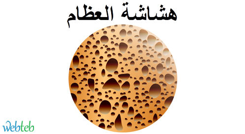 Watch the video: Types of Osteoporosis