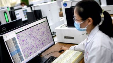 Better than experts .. Artificial Intelligence performs in the detection of ovarian cancer