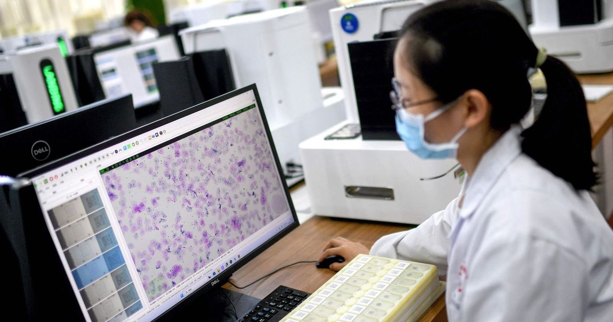 Better than experts .. Artificial Intelligence performs in the detection of ovarian cancer