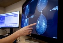 Study: Surgery may not benefit women with topical channel cancer