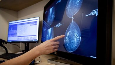 Study: Surgery may not benefit women with topical channel cancer