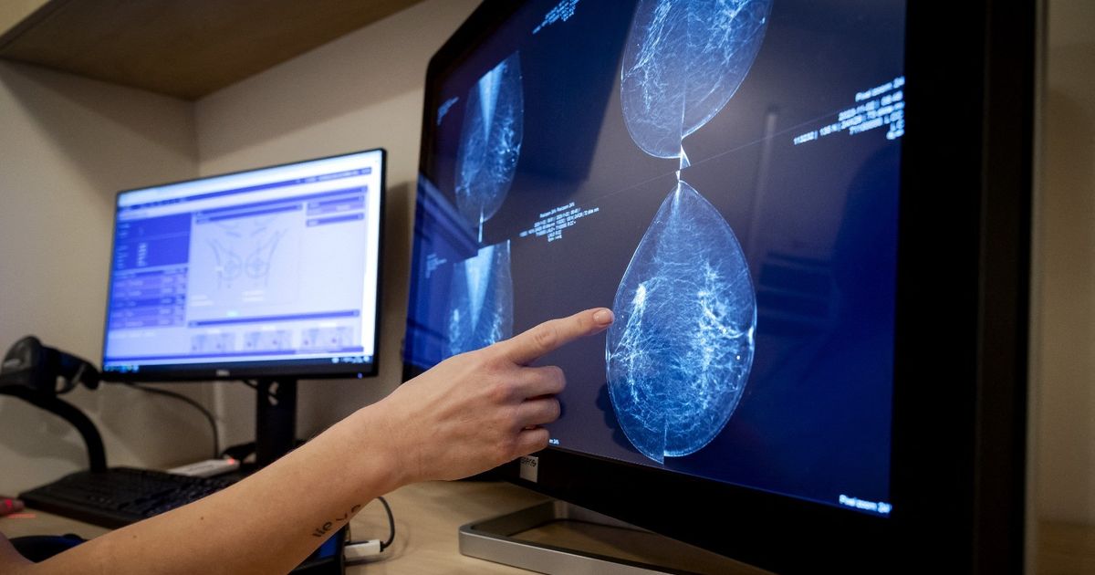 Study: Surgery may not benefit women with topical channel cancer