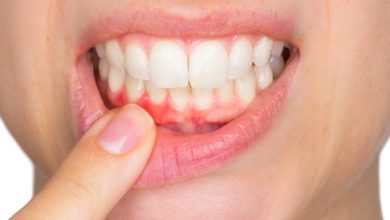 Gomitis: Symptoms, Causes and Treatment