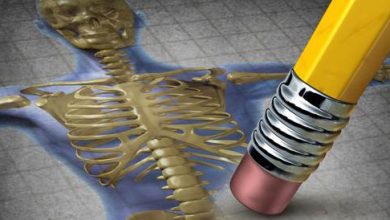 Treat Osteoporosis with pictures: Learn it