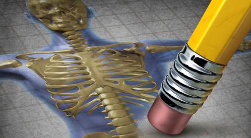Treat Osteoporosis with pictures: Learn it