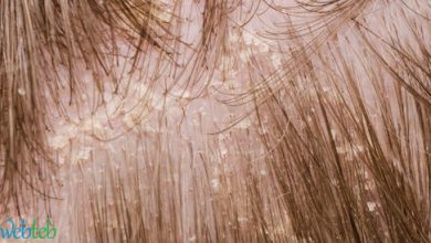 Watch in the video: Poetry Fungi