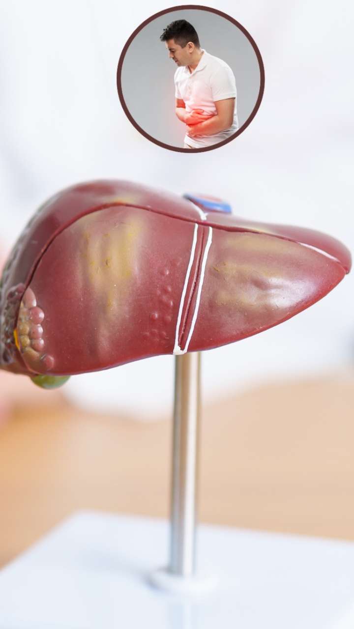 What is the problem with a fatty liver?