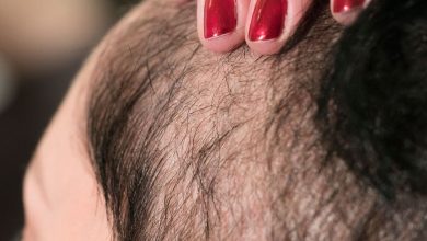 Intermittent fasting can delay hair growth